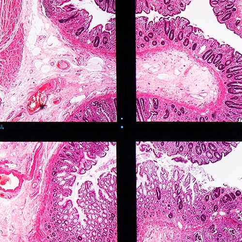 Digital Pathology